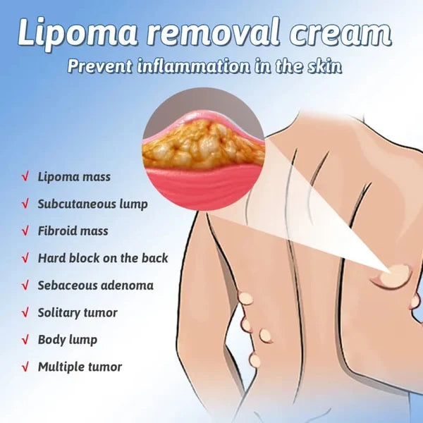 Herbal Lipoma Care Cream – Targeted Fatty Nodule Skincare Support – 50g